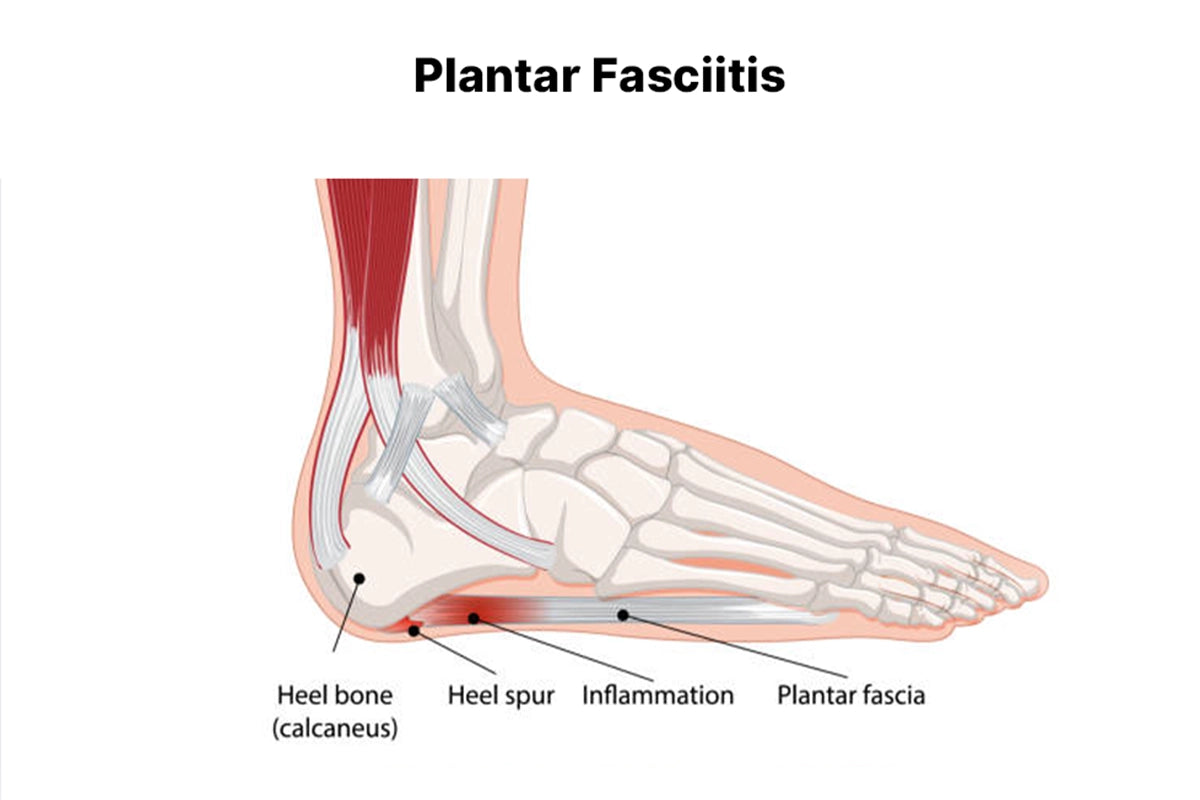 2best arch support shoes for plantar fasciitis