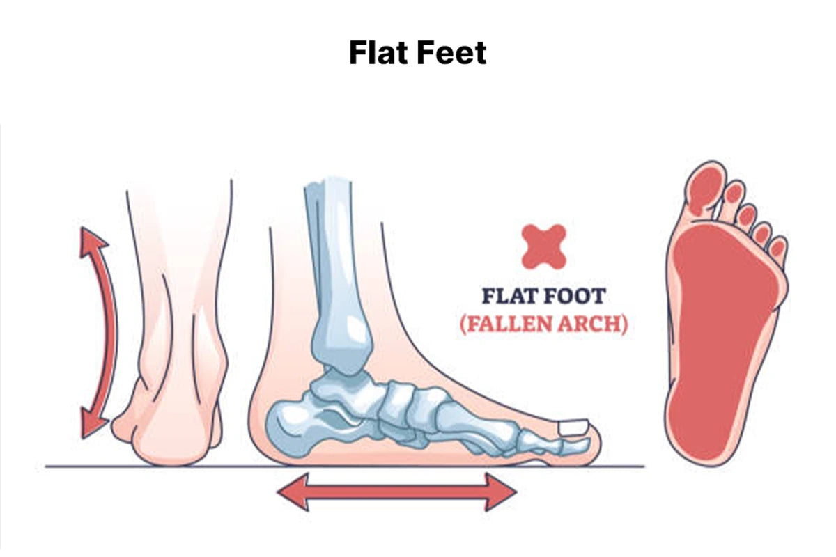 Comfortable men’s walking shoes for bunion pain