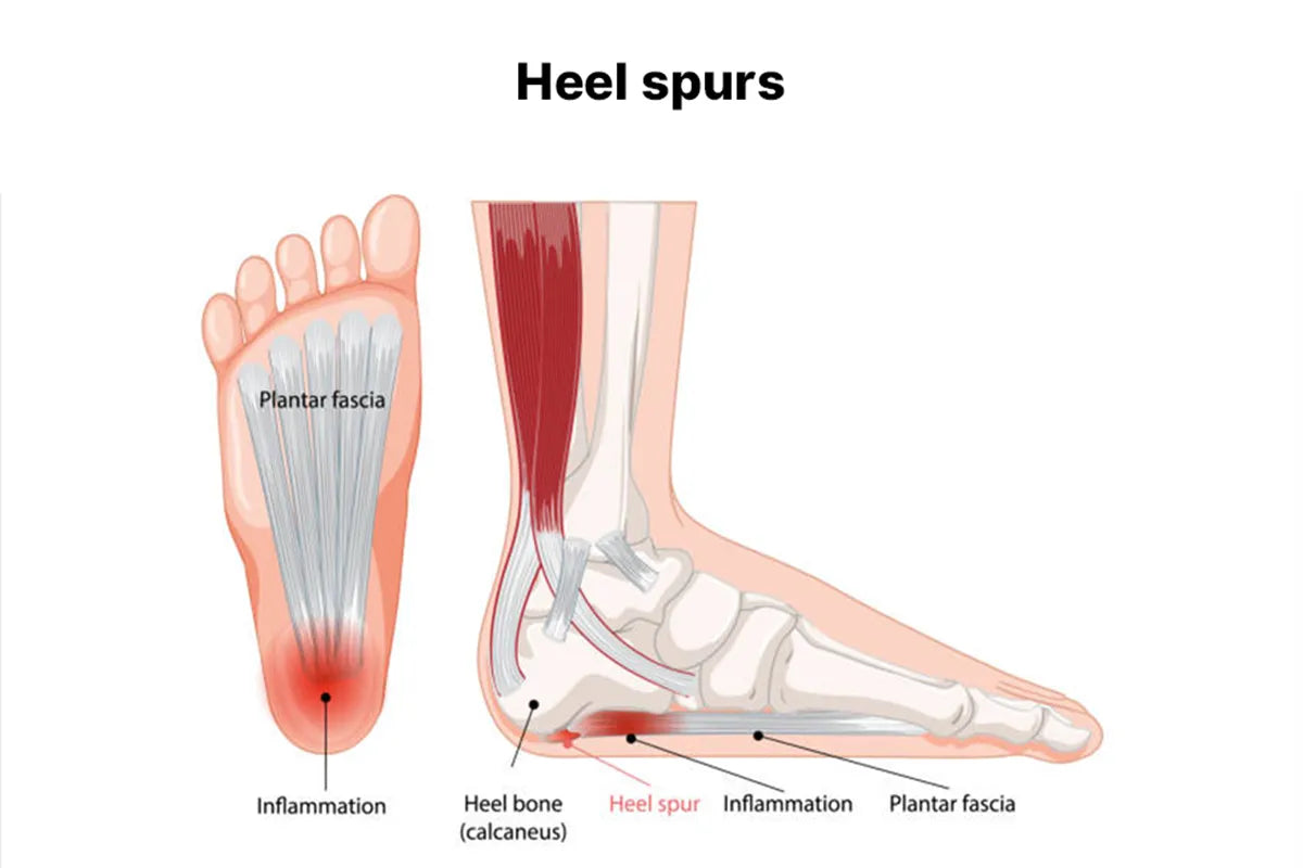 Comfortable men’s walking shoes for bunion pain