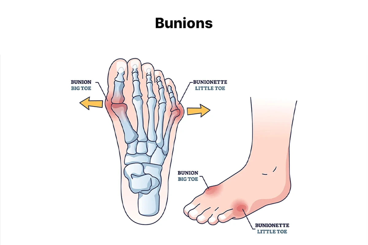 2best arch support shoes for plantar fasciitis